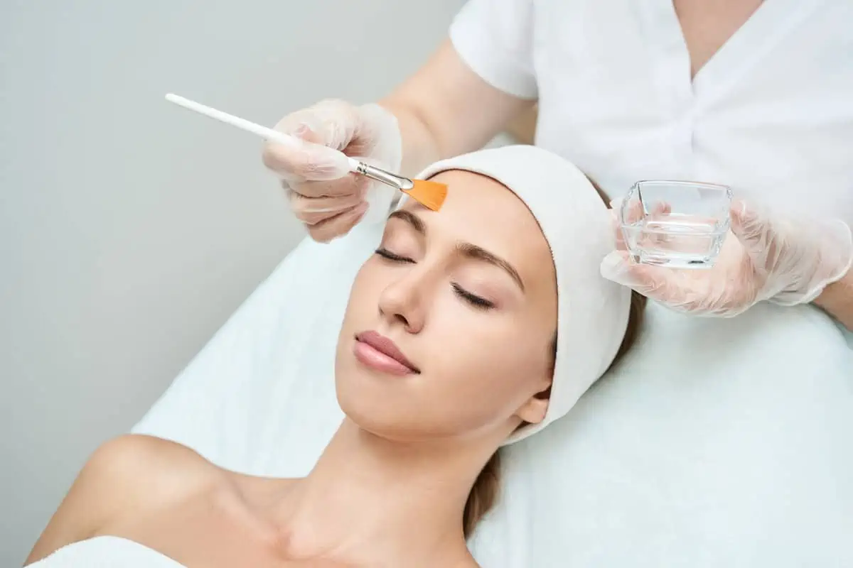 Chemical Peel in Madison WI by KSD Aesthetics